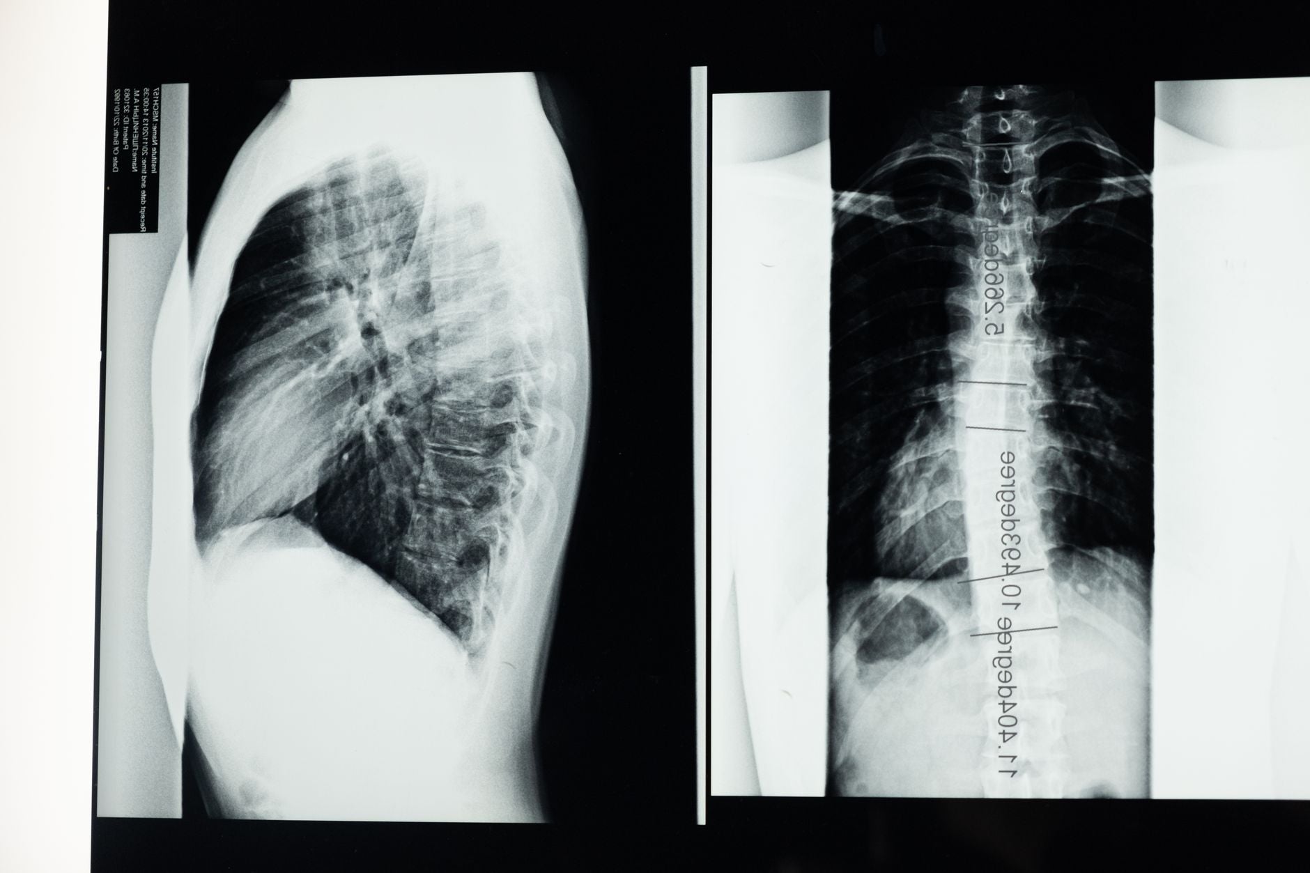 An x-ray of the human spine showing vertical alignment, the spine as a vertical conductor of inner state